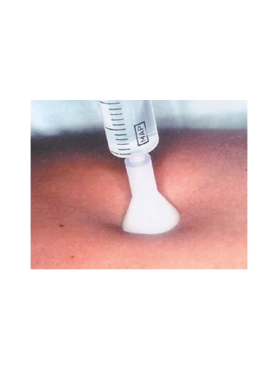 AGHI MESOTERAPIA G31 2,5MM 25PZ 2